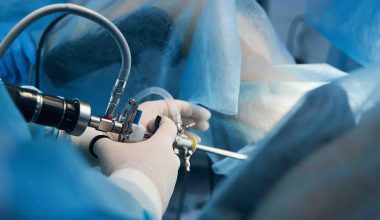 Photo of laparoscopic surgical instruent being used