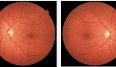 Analysis of retinal scans can indicate conditions such as diabetes and dementia